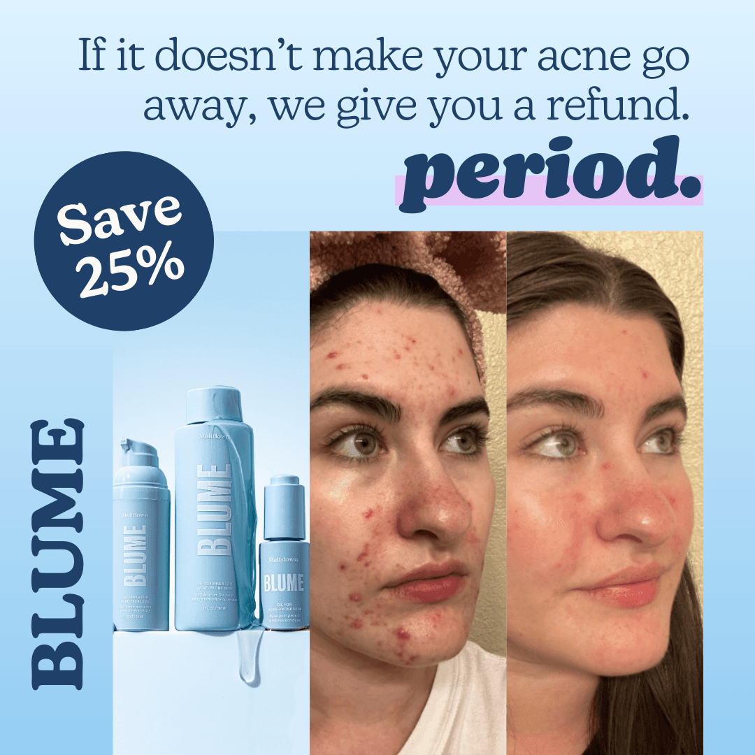 thumbnail-blume-statique-punchline-0