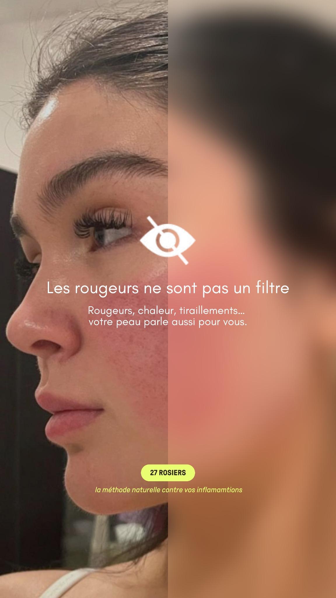 thumbnail-27-rosiers-pain-ad-0